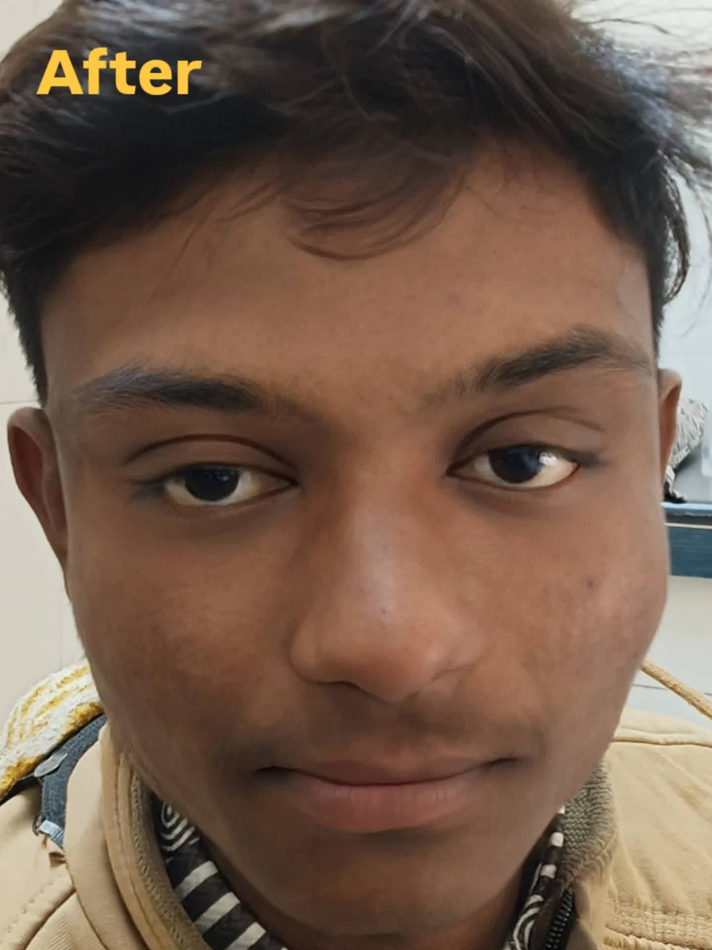 After treatment