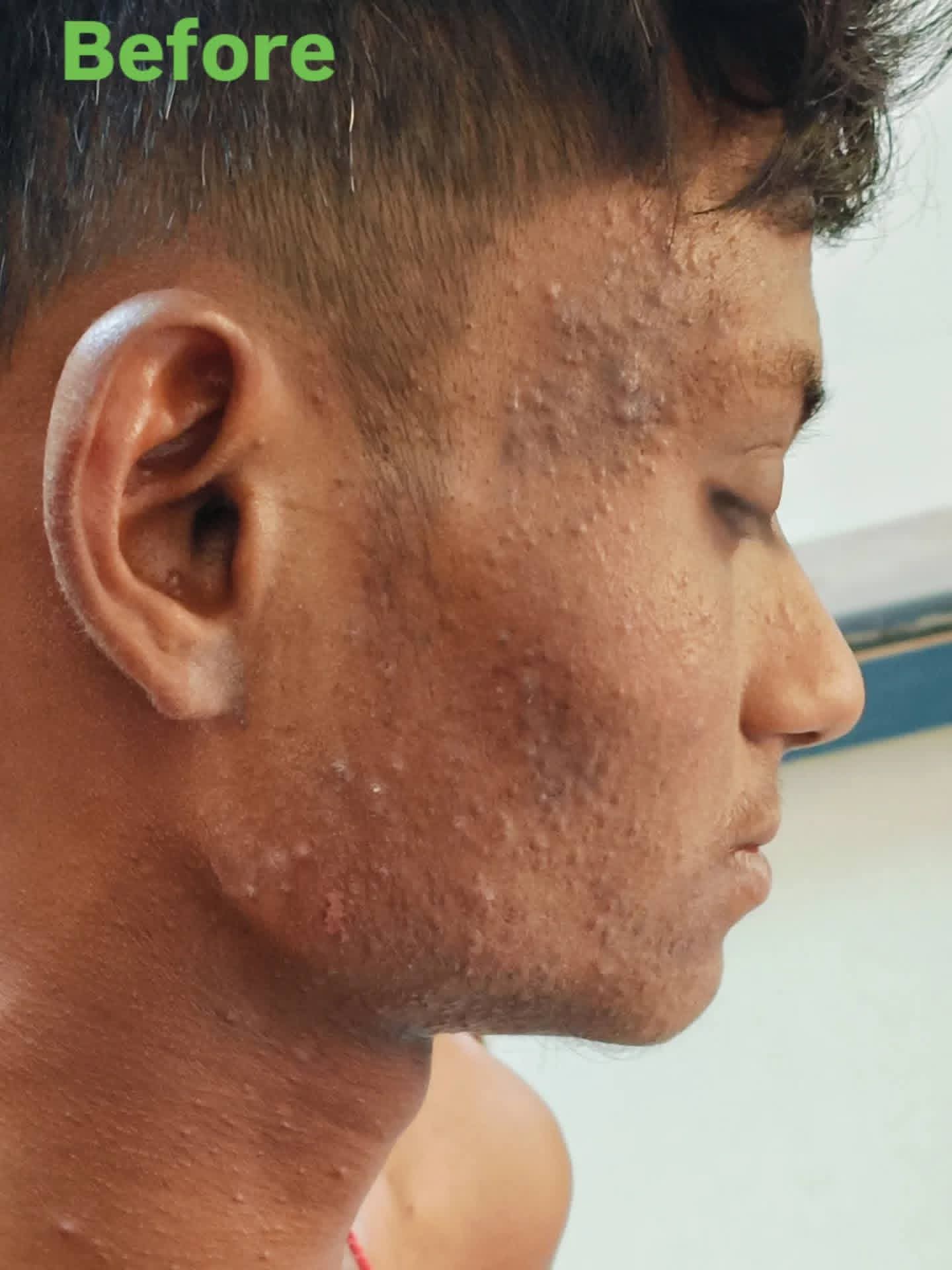 Before treatment