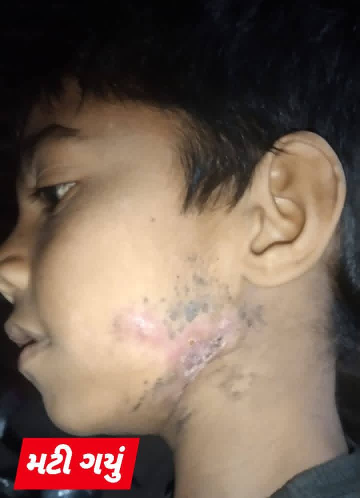 After treatment