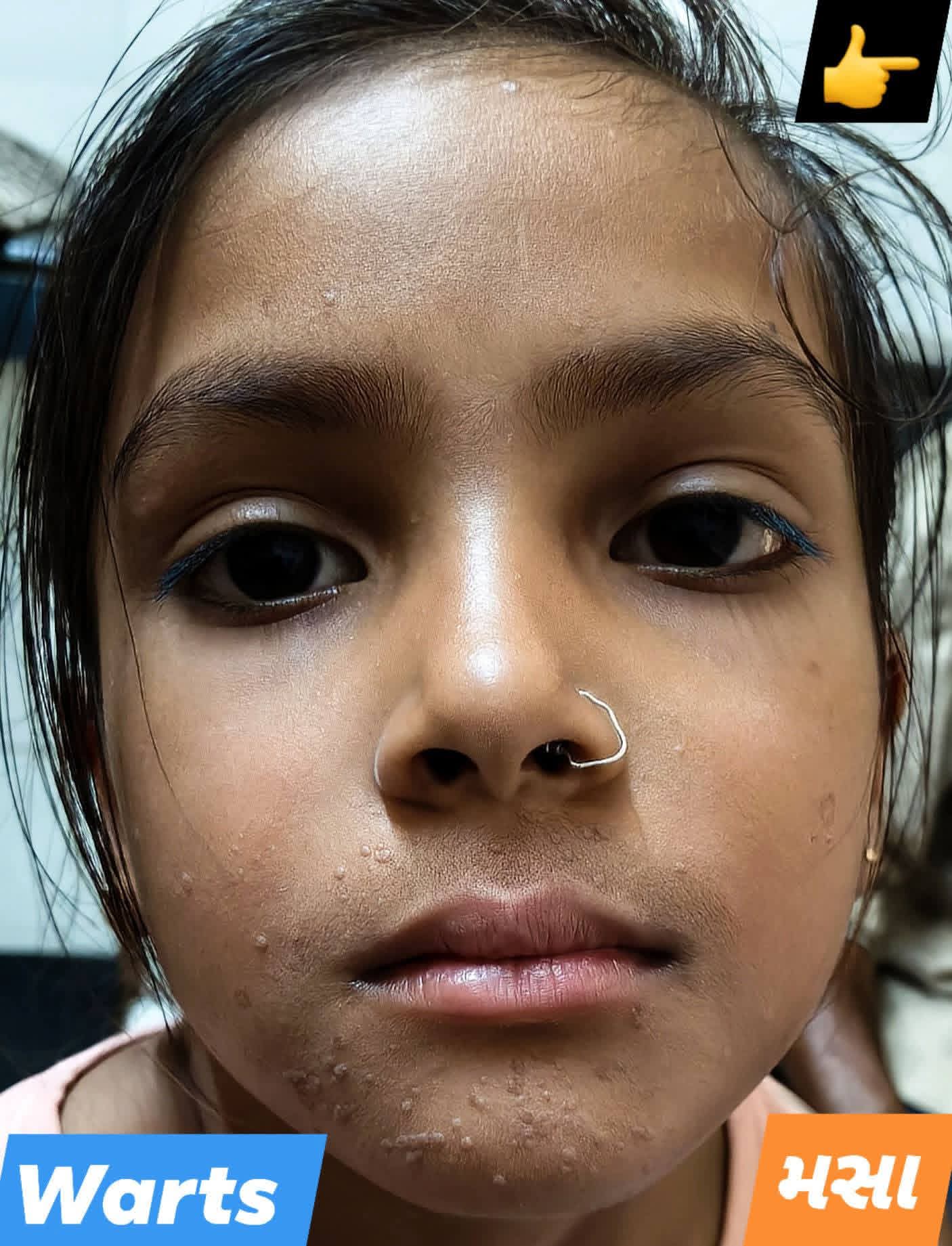 Before treatment